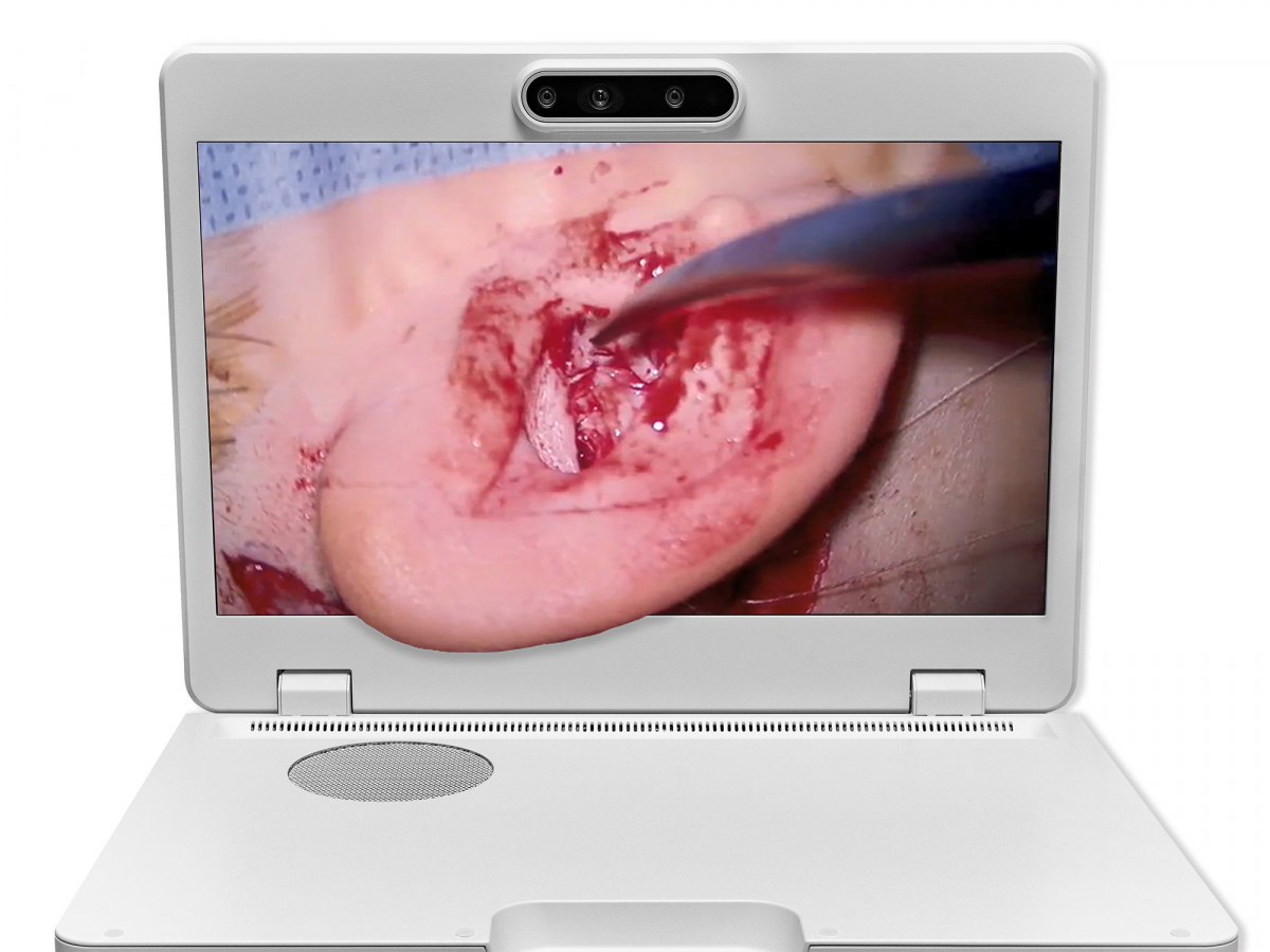 达擎之＂Heads-up 3D显微手术显示系统＂，整合4K裸眼3D显示及眼球追踪系统，具备快速追踪人眼移动位置功能，减轻医师长时间维持固定姿势的负担，让医师能有更宽广清晰的3D立体视野及更舒适的姿势来执行手术。